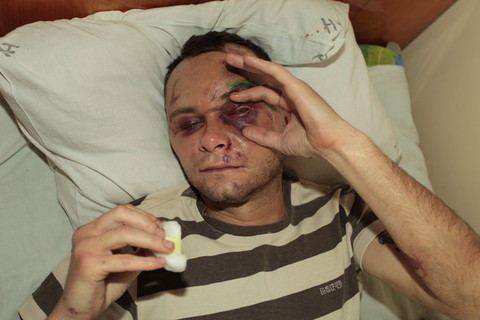 Актора, що грав у Ночному дозорі, викрали в Хмельницькому , фото №2 на сайті vsim.ua