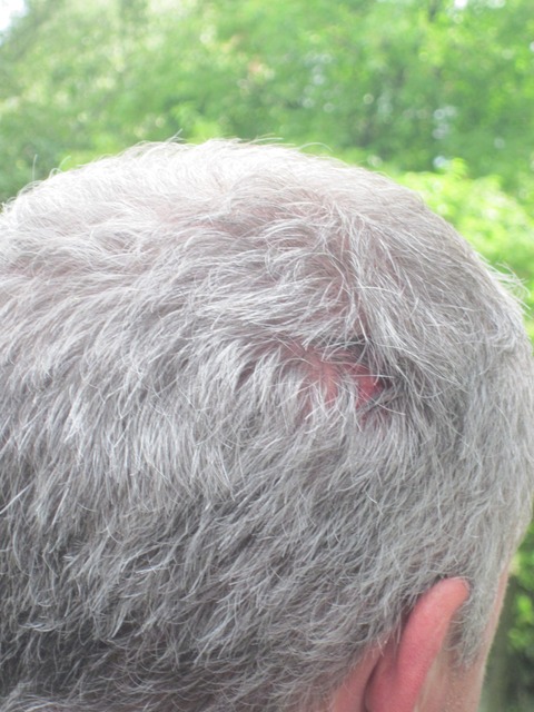 Вінницького політика побили в під’їзді власного будинку на сайті 20minut.ua Вінницького політика побили в під’їзді власного будинку, фото №2 на сайті 20minut.ua