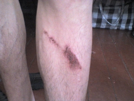 “Хлопці мусили різати собі вени” - кажуть в’язні з колонії на Тернопільщині, фото №1 на сайті 20minut.ua