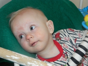 Андрійко, який народився без ручок і ніжок, має шанс, фото №1 на сайті 20minut.ua