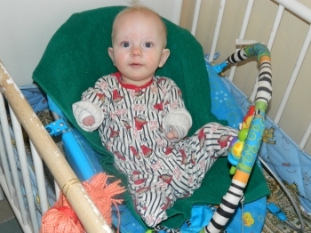 Андрійко, який народився без ручок і ніжок, має шанс, фото №2 на сайті 20minut.ua