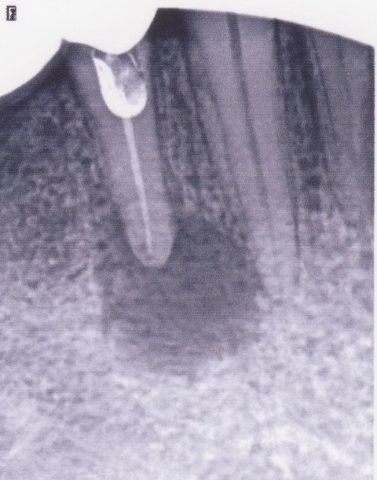 Стоматология Винницы  - Областная стоматологическая поликлиника (НА ПРАВАХ РЕКЛАМЫ), фото №17 на сайті 20minut.ua