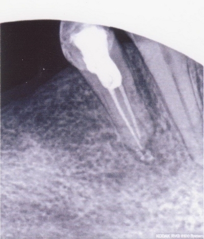 Стоматология Винницы  - Областная стоматологическая поликлиника (НА ПРАВАХ РЕКЛАМЫ), фото №18 на сайті 20minut.ua