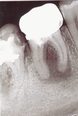 Стоматология Винницы  - Областная стоматологическая поликлиника (НА ПРАВАХ РЕКЛАМЫ), фото №21 на сайті 20minut.ua