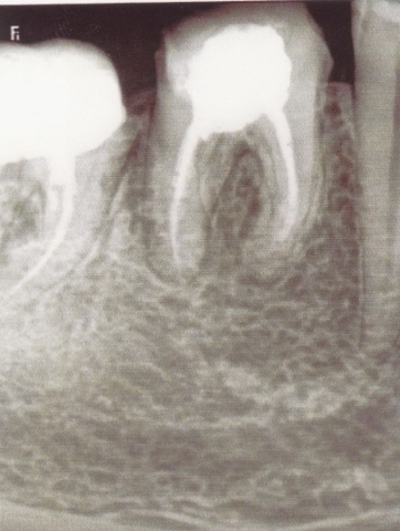 Стоматология Винницы  - Областная стоматологическая поликлиника (НА ПРАВАХ РЕКЛАМЫ), фото №22 на сайті 20minut.ua
