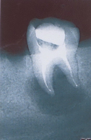 Стоматология Винницы  - Областная стоматологическая поликлиника (НА ПРАВАХ РЕКЛАМЫ), фото №23 на сайті 20minut.ua