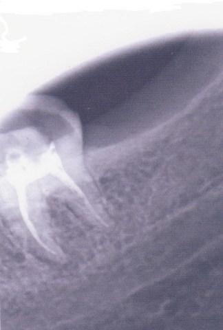 Стоматология Винницы  - Областная стоматологическая поликлиника (НА ПРАВАХ РЕКЛАМЫ), фото №24 на сайті 20minut.ua