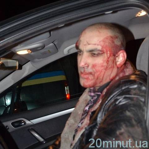 У Вінниці побили редактора сайту компроматів. Він вказує на Домбровського , фото №2 на сайті 20minut.ua