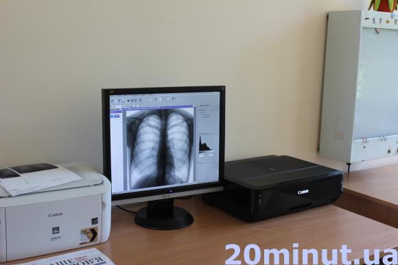 Тернопільські школярі зможуть проходити флюорографію в дитячій поліклініці, фото №2 на сайті 20minut.ua