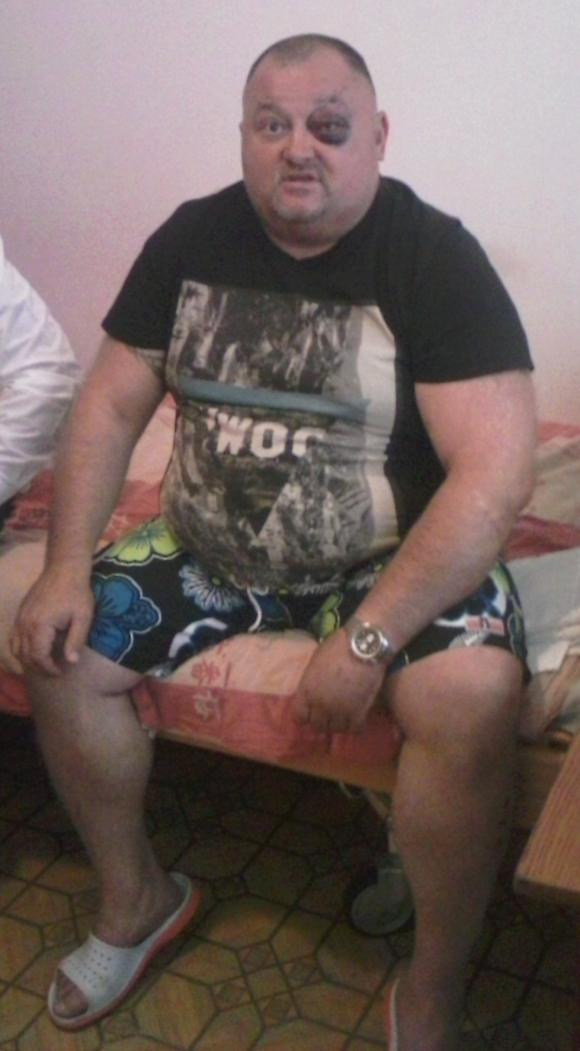 Борис Пасіченко, він же Боря Лексус, після нападу на нього каже: "У міліціонерів пелена на очах", фото №3 на сайті 20minut.ua