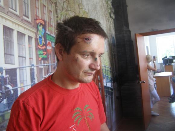 Двоє в балаклавах 15 хвилин били вінничанина на зйомній квартирі, фото №1 на сайті 20minut.ua