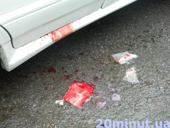 На Львівській ДТП - зіткнулися два авто (ОНОВЛЕНО), фото №3 на сайті 20minut.ua