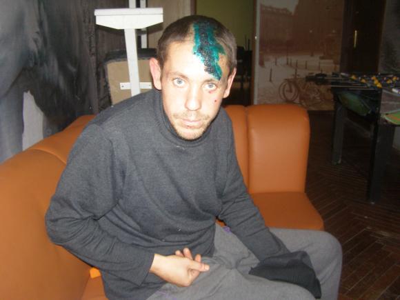 «На зупинці мене збила машина, за кермом якої був міліціонер», фото №1 на сайті 20minut.ua