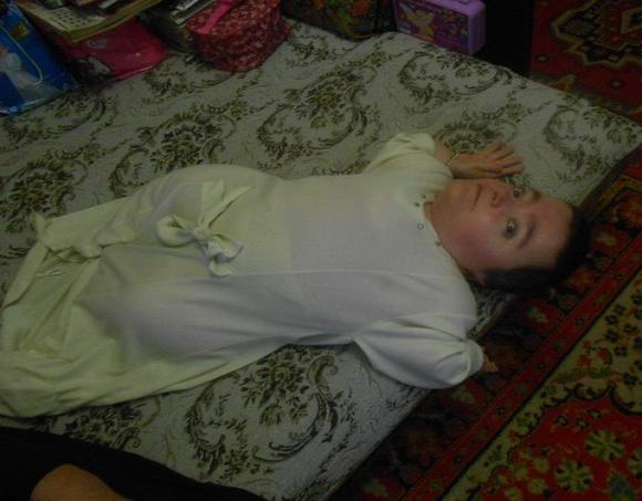 Найнижча жінка України - вінничанка. Лікарі хотіли зробити з неї піддослідного кролика, фото №1 на сайті 20minut.ua