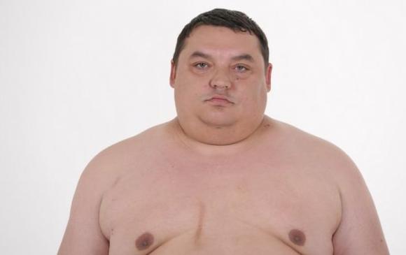 Шоу «Зважені та щасливі» виграв підопічний В’ячеслава Узелкова - мінус 60% ваги, фото №2 на сайті 20minut.ua