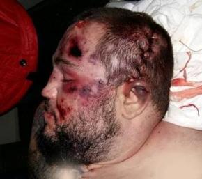 Смерть у хмельницькому СІЗО: Вдова каже, чоловіка "замовили", фото №1 на сайті vsim.ua