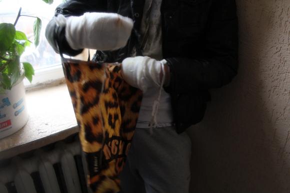 Нові поліцейські та “самооборонівці” зловили фейкового інваліда, фото №3 на сайті 20minut.ua