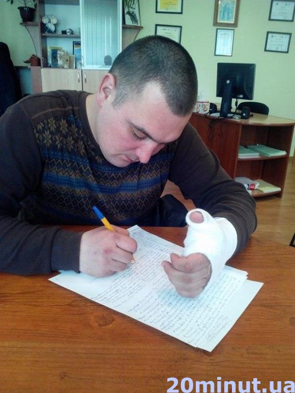 Патрульні поліцейські зламали тернополянину руку, фото №2 на сайті 20minut.ua