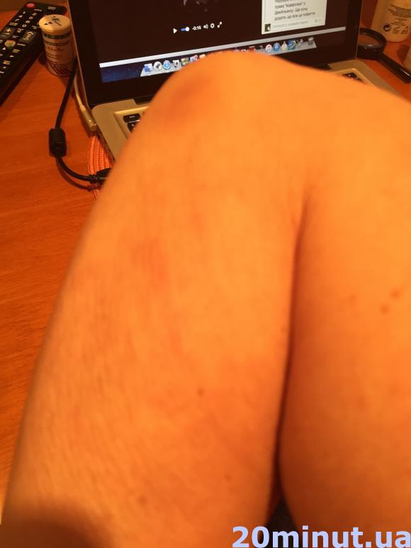 Зняттям побоїв закінчився для житомирянки Антикорупційний форум Саакашвілі. Відео. Фото, фото №2 на сайті 20minut.ua