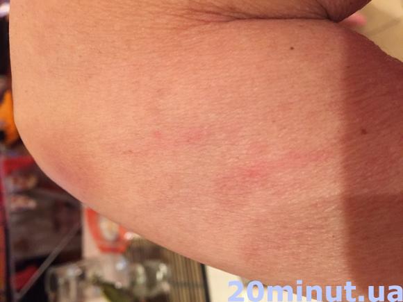 Зняттям побоїв закінчився для житомирянки Антикорупційний форум Саакашвілі. Відео. Фото, фото №3 на сайті 20minut.ua