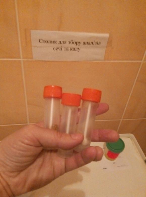 Чи можна аналізом калу перевірити якість вінницьких лабораторій? на сайті 20minut.ua Чи можна аналізом калу перевірити якість вінницьких лабораторій?, фото №1 на сайті 20minut.ua