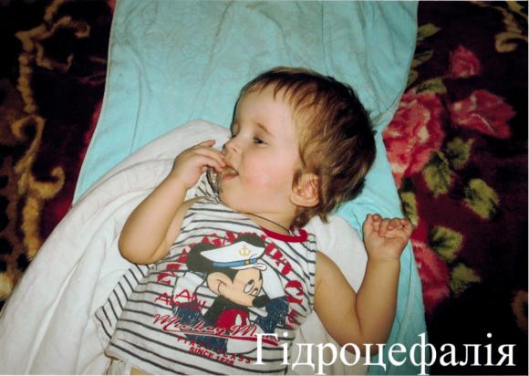 На благодійному концерті у Хмельницькому збиратимуть кошти на операцію хворого хлопчика, фото №1 на сайті vsim.ua