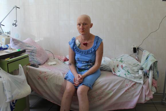 Після лікування у Пироговці вінничанка опинилась в реанімації без волосся та імунітету, фото №2 на сайті 20minut.ua
