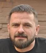 Після лікування у Пироговці вінничанка опинилась в реанімації без волосся та імунітету на сайті 20minut.ua Після лікування у Пироговці вінничанка опинилась в реанімації без волосся та імунітету, фото №4 на сайті 20minut.ua