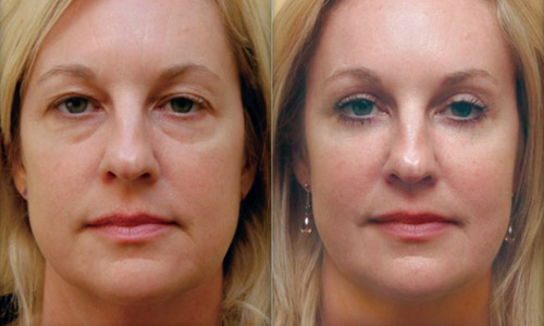 Зупинити час на обличчі? У нас це можливо! «Оксфорд Медікал Тернопіль» (новини компаній) на сайті 20minut.ua Зупинити час на обличчі? У нас це можливо! «Оксфорд Медікал Тернопіль» (новини компаній), фото №3 на сайті 20minut.ua