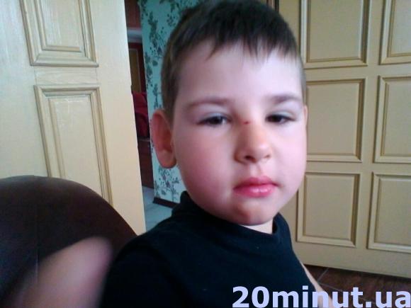 Допоможіть 4-річному Максимкові Чайковському жити на сайті 20minut.ua Допоможіть 4-річному Максимкові Чайковському жити, фото №1 на сайті 20minut.ua