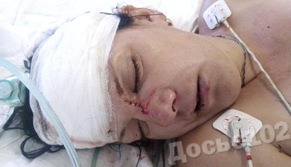 Під Тернополем жінка потрапила під колеса вантажівки. Правоохоронці шукають рідних, фото №2 на сайті 20minut.ua