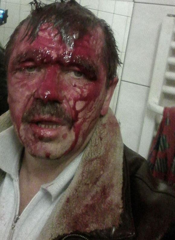 У Хмільнику жорстоко побили керівника Самооборони. Бандити приїхали з Вінниці на чужих номерах, фото №1 на сайті 20minut.ua