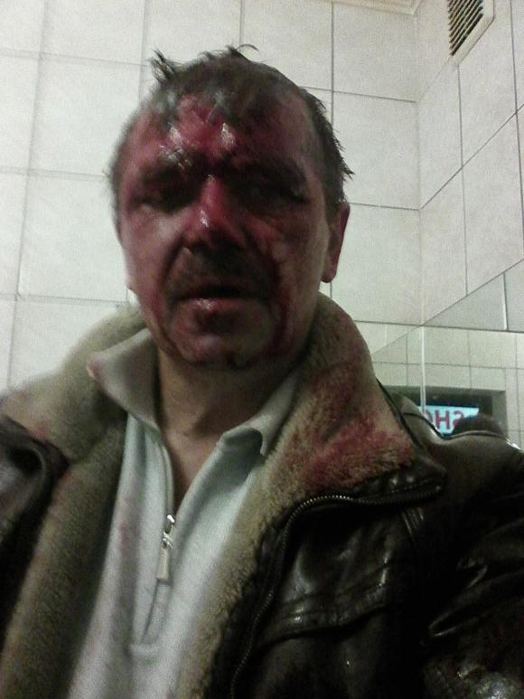 У Хмільнику жорстоко побили керівника Самооборони. Бандити приїхали з Вінниці на чужих номерах, фото №2 на сайті 20minut.ua